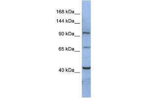 WB Suggested Anti-RBM12 Antibody Titration:  0. (RBM12 抗体  (N-Term))