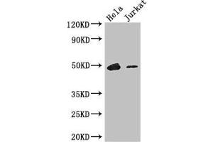 Western Blot Positive WB detected in: Hela whole cell lysate, Jurkat whole cell lysate All lanes: IKZF1 antibody at 3. (IKZF1 抗体  (AA 1-265))