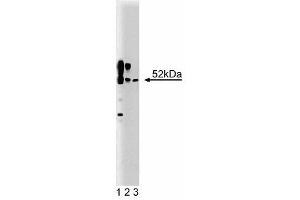 Western blot analysis of CaM Kinase II on a rat cerebrum lysate (First Panel). (CAMK2A 抗体  (AA 448-460))
