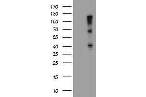 FBXO31 antibody