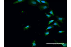 Immunofluorescence of purified MaxPab antibody to PAK6 on HeLa cell. (PAK6 抗体  (AA 1-681))