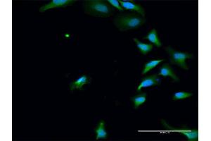 Immunofluorescence of purified MaxPab antibody to PAK6 on HeLa cell.
