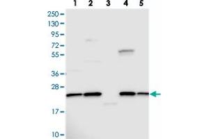 Western blot analysis of Lane 1: RT-4, Lane 2: U-251 MG, Lane 3: Human Plasma, Lane 4: Liver, Lane 5: Tonsil with NPVF polyclonal antibody . (NPVF 抗体)
