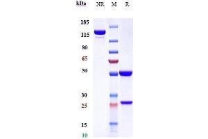 Anti-CD14 Reference Antibody (atibuclimab) on SDS-PAGE under reducing (R) condition. (Recombinant CD14 (Atibuclimab Biosimilar) 抗体)