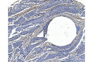 IHC analysis of Filamin A/FLNA using anti-Filamin A/FLNA antibody (ABIN7601783).