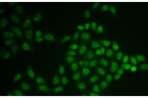 Immunofluorescence analysis of U2OS cells using BTG1 Polyclonal Antibody (BTG1 抗体)