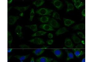 Immunofluorescence analysis of L929 cells using NDUFB7 Polyclonal Antibody at dilution of 1:100 (40x lens). (NDUFB7 抗体)