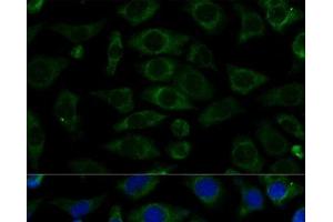 Immunofluorescence analysis of L929 cells using NDUFB7 Polyclonal Antibody at dilution of 1:100 (40x lens). (NDUFB7 抗体)