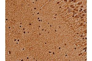 ABIN6276980 at 1/200 staining human brain tissue sections by IHC-P. (TRIM21 抗体  (C-Term))