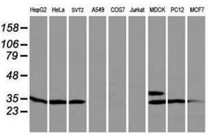 Image no. 1 for anti-Protein tyrosine Phosphatase, Non-Receptor Type 7 (PTPN7) antibody (ABIN1500502) (PTPN7 抗体)