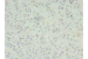 Immunohistochemistry (IHC) image for anti-Zinc Finger CCCH-Type Containing 7A (ZC3H7A) (AA 1-167) antibody (ABIN7176040)