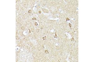 Immunohistochemistry of paraffin-embedded human brain using CX3CL1 Rabbit pAb (ABIN6129035, ABIN6139265, ABIN6139266 and ABIN6218481) at dilution of 1:150 (40x lens). (CX3CL1 抗体  (AA 365-397))