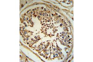 Immunohistochemistry (IHC) image for anti-Inhibin, alpha (INHA) antibody (ABIN3002774) (Inhibin alpha 抗体)