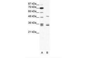 Image no. 1 for anti-Zinc Finger Protein 488 (ZNF488) (C-Term) antibody (ABIN202284) (ZNF488 抗体  (C-Term))