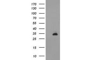 Image no. 1 for anti-CTD (Carboxy-terminal Domain, RNA Polymerase II, Polypeptide A) Small Phosphatase 1 (CTDSP1) antibody (ABIN1497680) (CTDSP1 抗体)