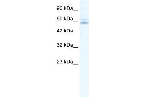 WB Suggested Anti-ZNF141 Antibody Titration:  2. (ZNF141 抗体  (N-Term))