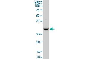 RDH13 MaxPab polyclonal antibody. (RDH13 抗体  (AA 1-260))