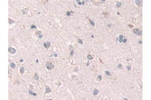 Immunohistochemistry (IHC) image for anti-Growth Factor Receptor-Bound Protein 10 (GRB10) (AA 392-594) antibody (ABIN7436048)