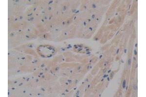 IHC-P analysis of Mouse Heart Tissue, with DAB staining. (ABCA1 抗体  (AA 1404-1663))
