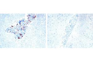 Image no. 1 for anti-Tumor Necrosis Factor (Ligand) Superfamily, Member 13 (TNFSF13) antibody (ABIN187283) (TNFSF13 抗体)