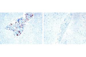 Image no. 1 for anti-Tumor Necrosis Factor (Ligand) Superfamily, Member 13 (TNFSF13) antibody (ABIN187283)