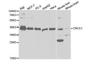 Western blot analysis of extracts of various cell lines, using ERCC1 antibody. (ERCC1 抗体  (AA 1-323))
