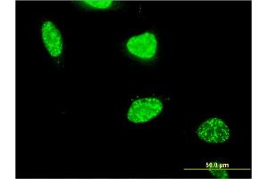 Immunofluorescence of monoclonal antibody to PAXIP1 on HeLa cell. (PAXIP1 抗体  (AA 868-975))