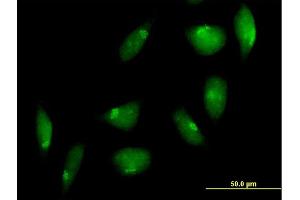 Immunofluorescence of purified MaxPab antibody to TTK on HeLa cell. (Mps1 抗体  (AA 1-857))