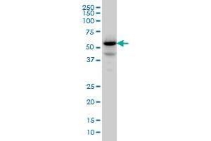 PPM1F monoclonal antibody (M01), clone 2A9 Western Blot analysis of PPM1F expression in Jurkat .