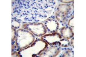Immunohistochemistry (Paraffin-embedded Sections) (IHC (p)) image for anti-Naked Cuticle Homolog 2 (NKD2) (AA 373-401), (C-Term) antibody (ABIN953712)