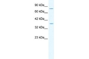 MCM4 antibody used at 1. (MCM4 抗体  (Middle Region))
