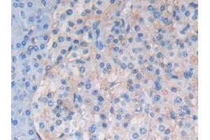 Detection of ATF6 in Human Pancreas Tissue using Polyclonal Antibody to Activating Transcription Factor 6 (ATF6) (ATF6 抗体  (AA 423-646))