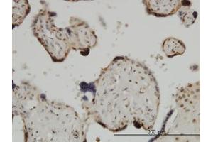 Image no. 1 for anti-Zic Family Member 4 (ZIC4) (AA 249-320) antibody (ABIN466251) (ZIC4 抗体  (AA 249-320))