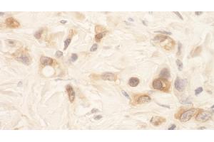 Immunohistochemistry (IHC) image for anti-serine threonine Kinase 39 (STK39) (AA 425-450) antibody (ABIN7448809) (STK39 抗体  (AA 425-450))