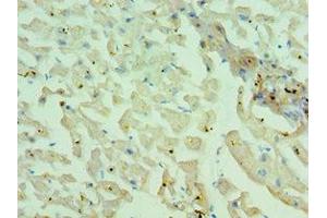 Immunohistochemistry (IHC) image for anti-Myosin Heavy Chain 1, Skeletal Muscle, Adult (MYH1) (AA 1-100) antibody (ABIN7160559)