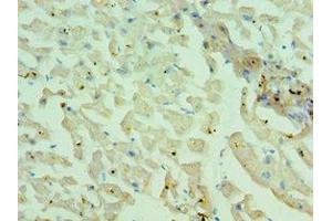 Immunohistochemistry of paraffin-embedded human heart tissue using ABIN7160559 at dilution of 1:100 (MYH1 抗体  (AA 1-100))