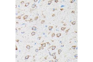 Immunohistochemistry of paraffin-embedded rat brain using CYLD Rabbit pAb (ABIN1679467, ABIN3018138, ABIN3018139 and ABIN6220378) at dilution of 1:100 (40x lens). (CYLD 抗体  (AA 654-953))