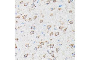 Immunohistochemistry of paraffin-embedded rat brain using CYLD Rabbit pAb (ABIN1679467, ABIN3018138, ABIN3018139 and ABIN6220378) at dilution of 1:100 (40x lens).