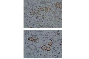 Sample Type:  Human Kidney   Dilution:  1:100 (CYP1A1 抗体  (Middle Region))