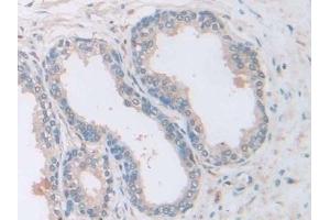 Immunohistochemistry (IHC) image for anti-Adenylyl Cyclase Associated Protein 2 (CAP2) (AA 317-455) antibody (ABIN7435160)