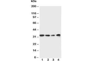 Western blot testing of MyD88 antibody and Lane 1:  rat spleen;  2: rat thymus;  3: Jurkat;  4: Raji cell lysate. (MYD88 抗体  (Middle Region))
