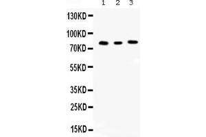 Western blot analysis of Cyclin T1 expression in rat kidney extract ( Lane 1), mouse spleen extract ( Lane 2) and JURKAT whole cell lysates ( Lane 3). (Cyclin T1 抗体  (Middle Region))