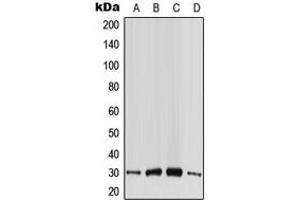 Western blot analysis of CABP4 expression in HeLa (A), HepG2 (B), SP2/0 (C), PC12 (D) whole cell lysates. (CABP4 抗体  (Center))