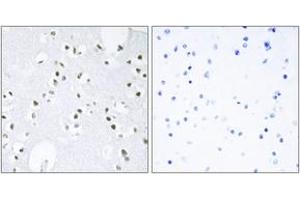 Immunohistochemistry analysis of paraffin-embedded human brain tissue, using c-Jun (Ab-243) Antibody. (C-JUN 抗体  (AA 210-259))