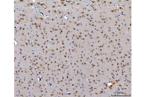 IHC analysis of CEP250 using anti-CEP250 antibody (ABIN7602053). (CEP250 抗体  (AA 563-853))
