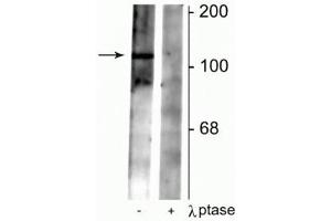 Western blot of rat synaptic membrane lysate showing specific immunolabeling of the ~102 kDa GABAB R2 protein phosphorylated at Ser783 in the first lane (-). (GABBR2 抗体  (pSer783))