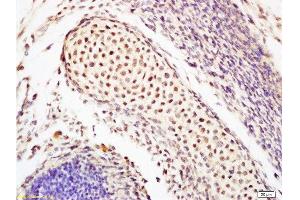 Immunohistochemistry (Paraffin-embedded Sections) (IHC (p)) image for anti-POU Class 5 Homeobox 1 (POU5F1) (AA 201-300) antibody (ABIN737826)
