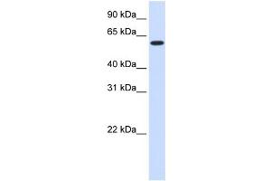 WB Suggested Anti-UGT8 Antibody Titration:  0. (UGT8 抗体  (Middle Region))