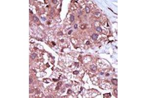 Image no. 2 for anti-Activin A Receptor Type II-Like 1 (ACVRL1) (C-Term) antibody (ABIN360125) (ACVRL1 抗体  (C-Term))