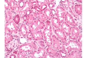 Immunohistochemistry (IHC) image for anti-Prostaglandin E Receptor 3 (Subtype EP3) (PTGER3) (N-Term) antibody (ABIN2451692)